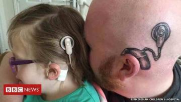 Einsatz von Hörprothese ist Entscheidung der Eltern – Cochlea Implantat CI