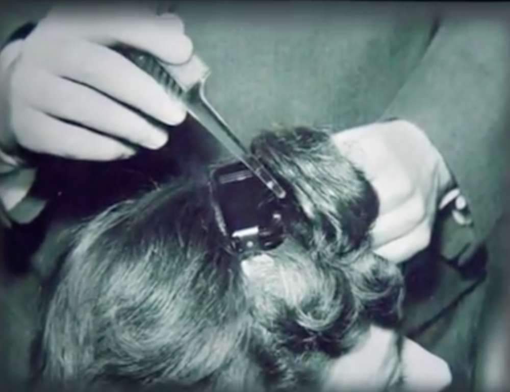 Unter dem Haar Hörgerät