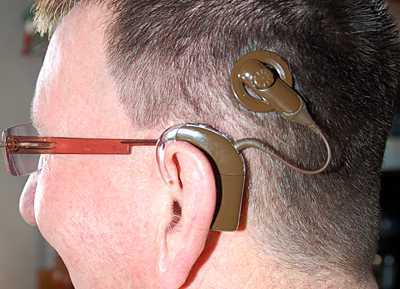 Cochlea-implantat