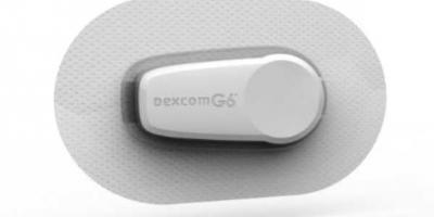 Dexcom 6