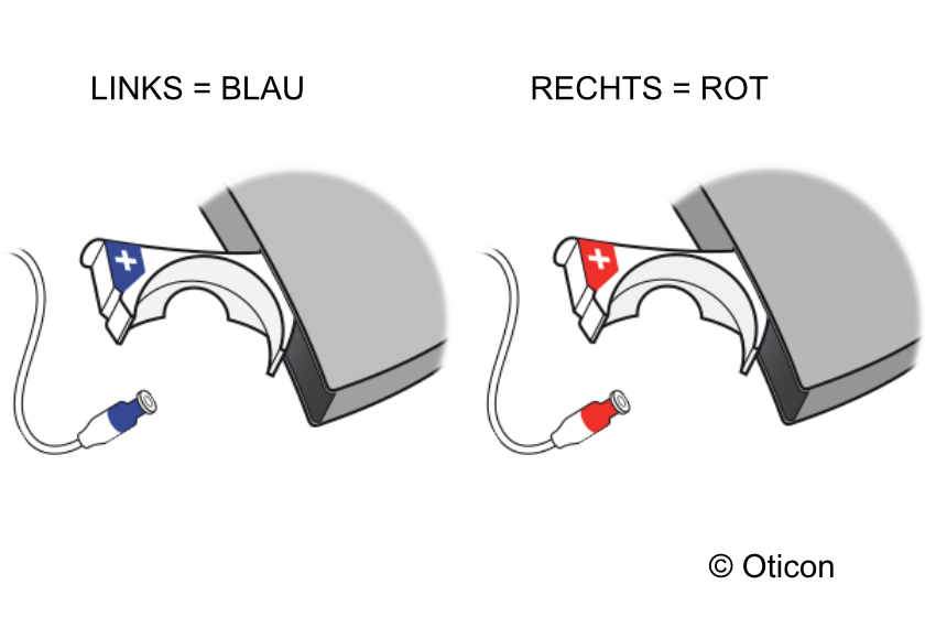 Wo ist links und rechts bei Hörgeräten? Nie mehr verwechseln