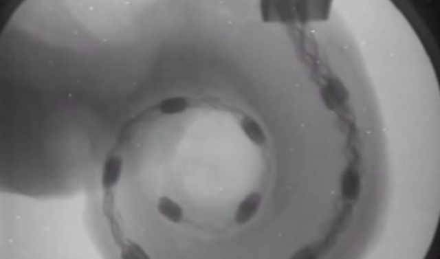Beeindruckende Bilder aus der Cochlea